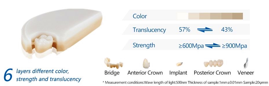 3D multi layer dental zirconia feature