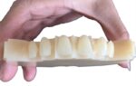 four layers multilayers dental pmma restoration effect