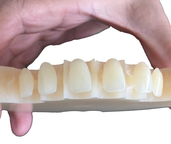 four layers multilayers dental pmma restoration effect