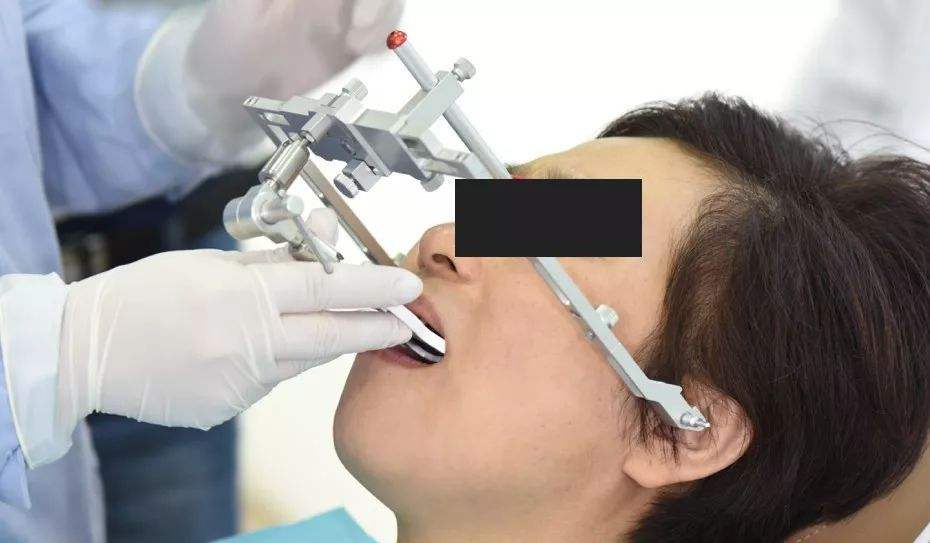 facebow dental record
