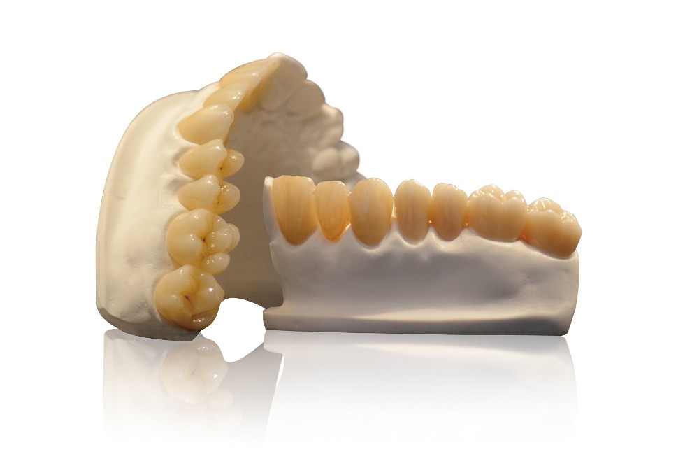 3d multi layer zirconia restoration cosmetic effect