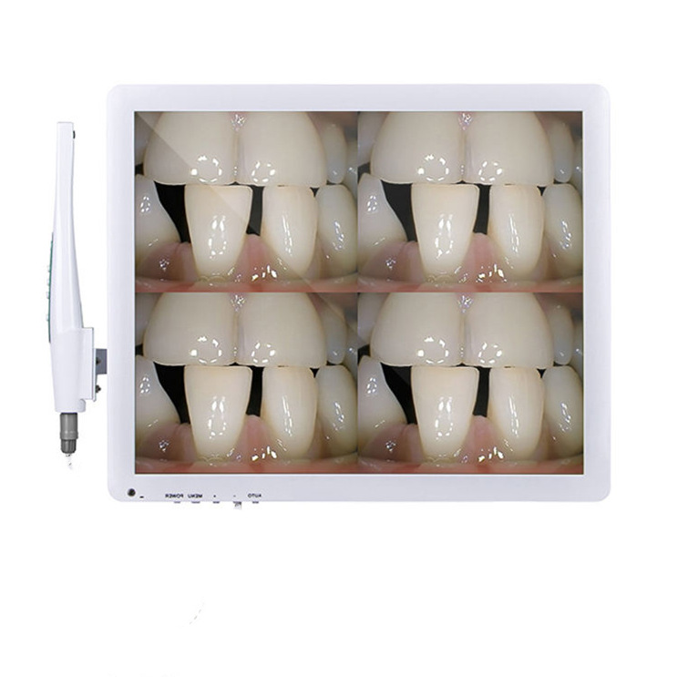 4 picture in oral image cameral system dental