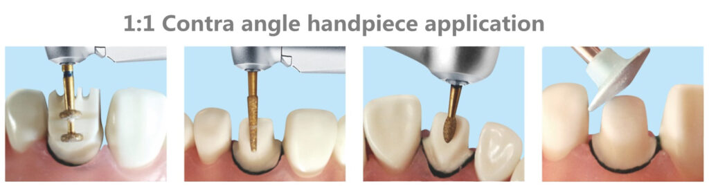 dentistry application of speed 1:1 contra angle handpiece