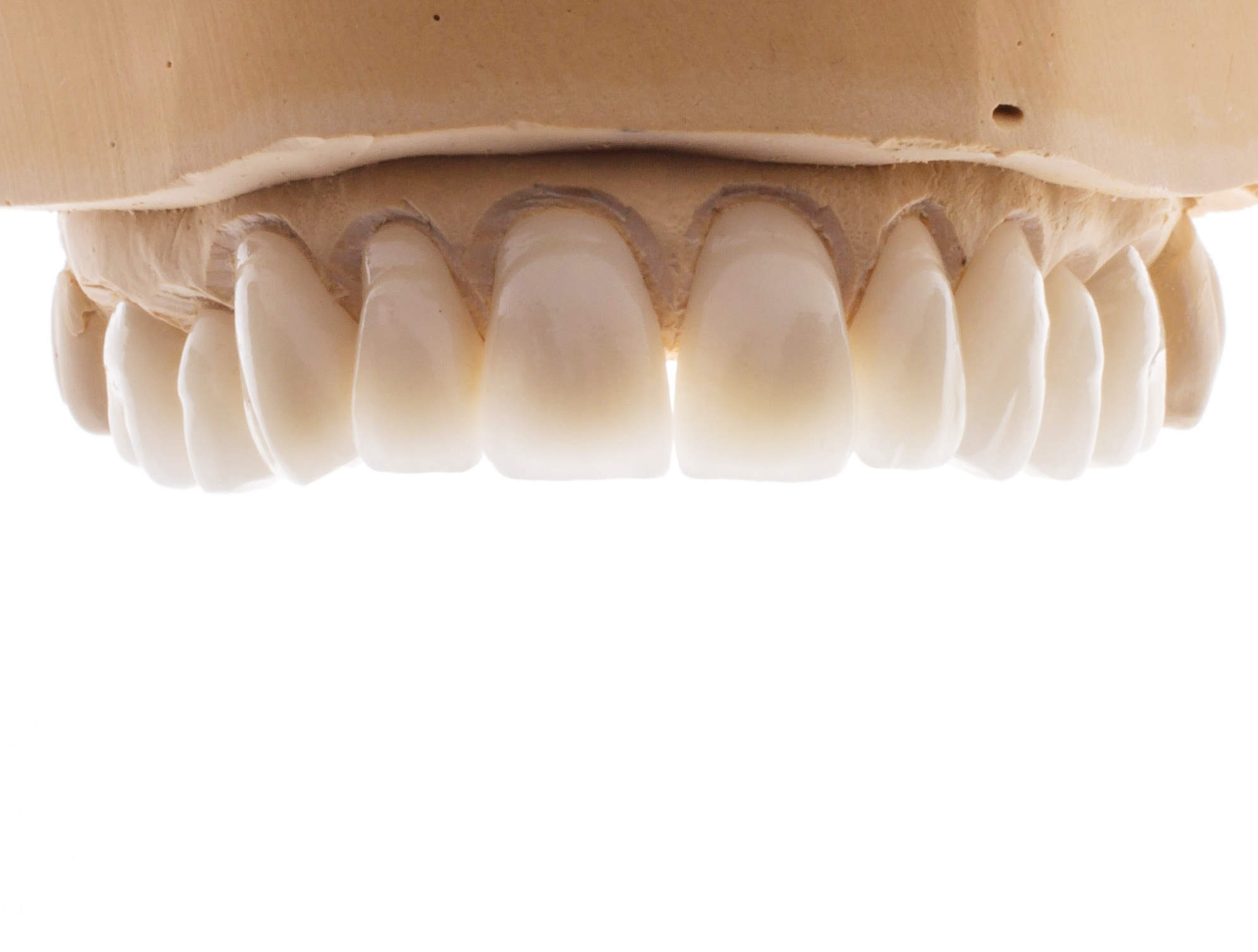 zirconia cad cam crown material made