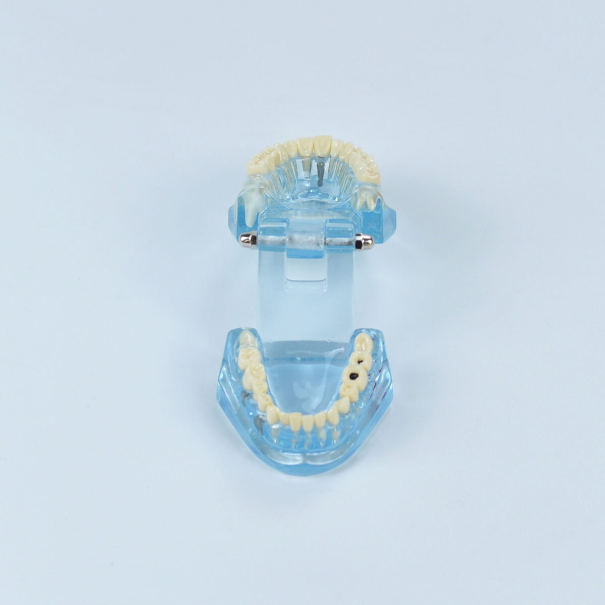 Patient education dental implant models