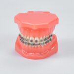 Orthodontic diagnosis demonstration model