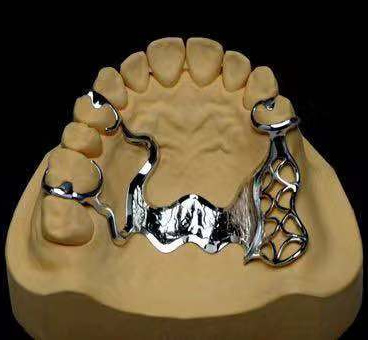 Cobalt chrome dental prosthesis partial application