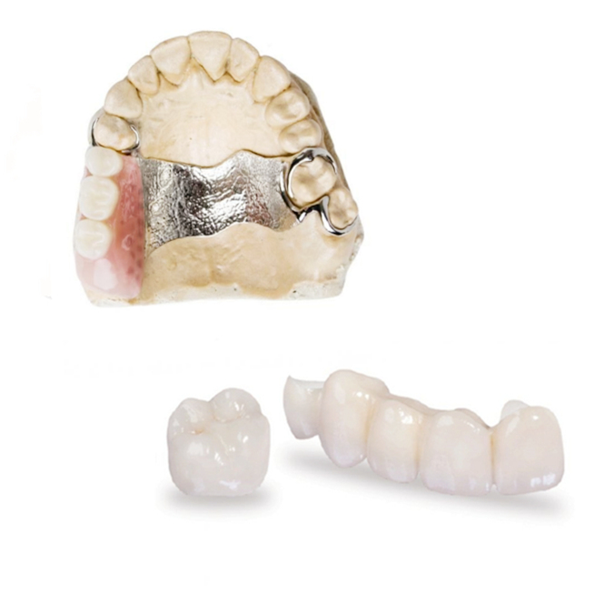 cobalt chrome metal and zirconia prosthesis teeth
