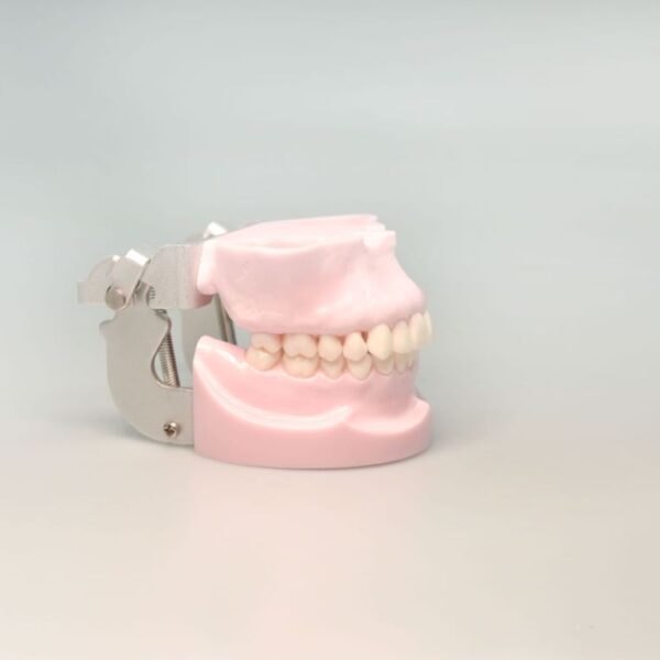 Implant Anchorage Nail Mode with articulator
