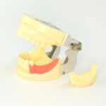 Implant tooth dental model
