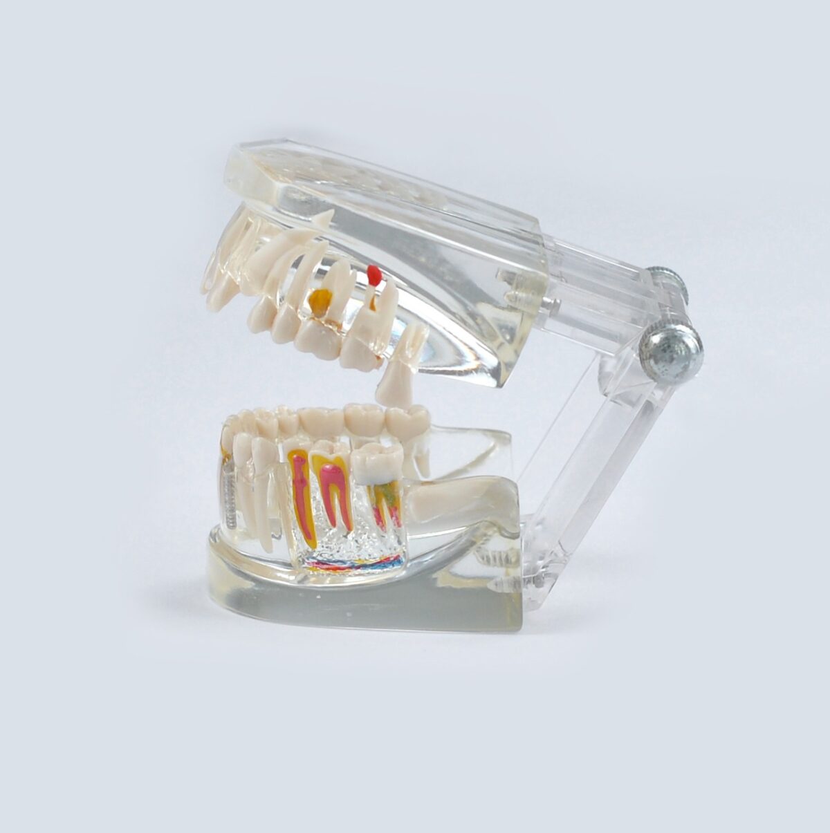 Transparent Pathological Teeth Study Model