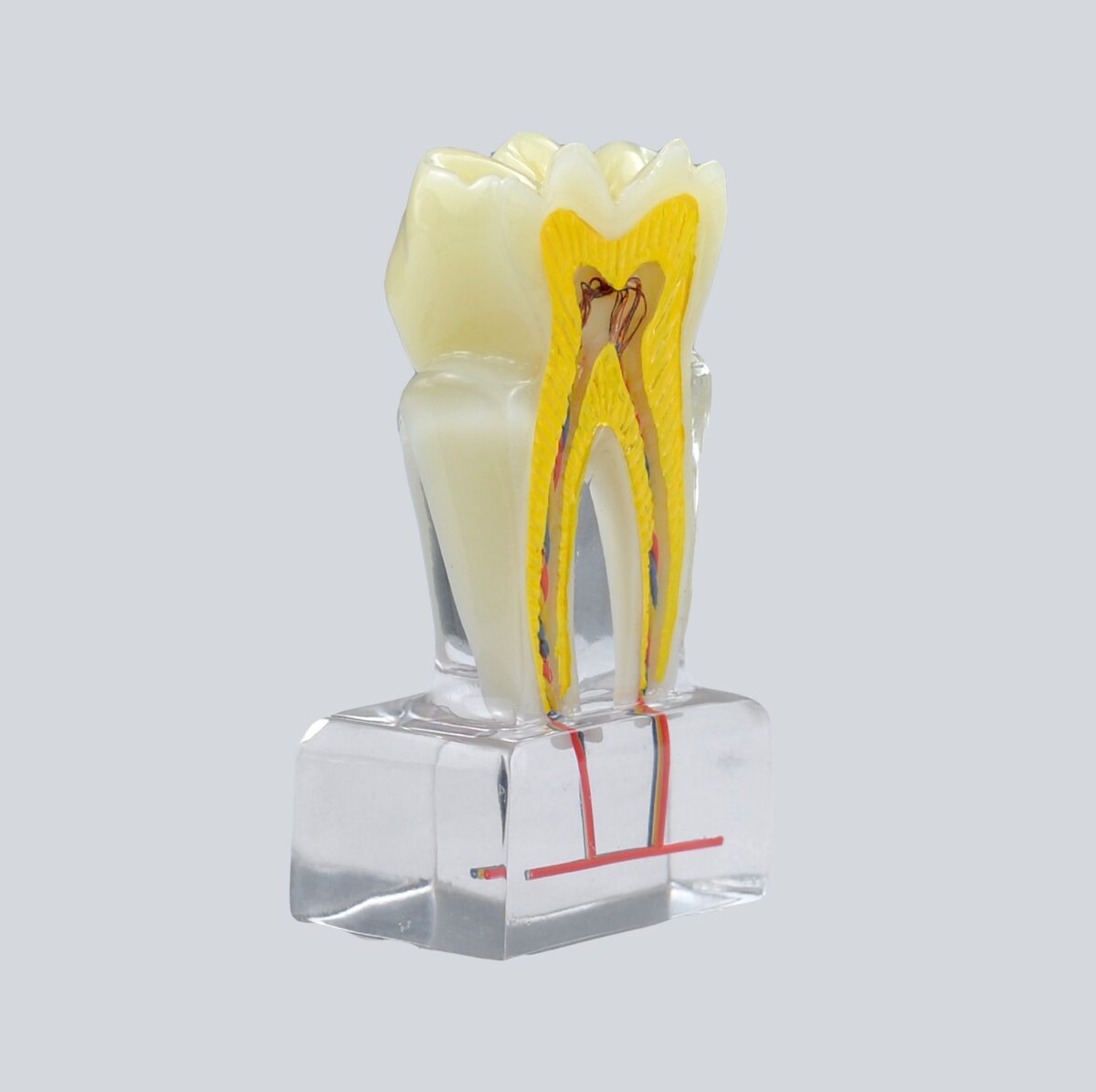 anatomical pupl cavity model
