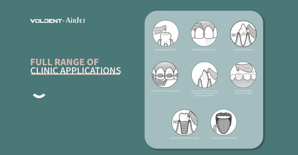 application of air prophy jet in dentistry