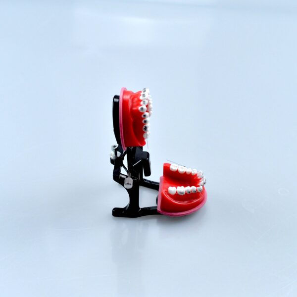 braces model with articulator