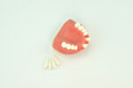 educational model of tooth missing
