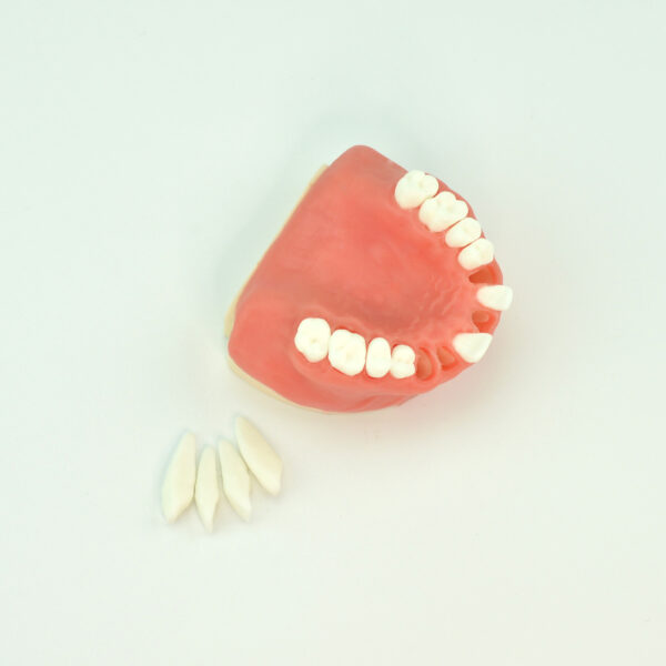 educational model of tooth missing