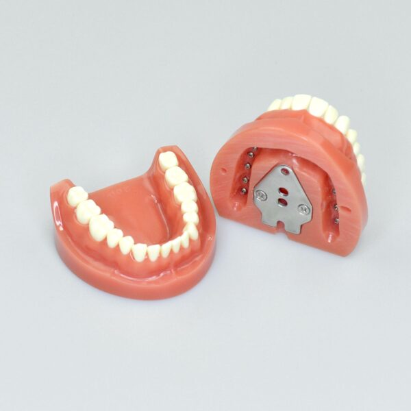 hard gingiva teeth model without articulator