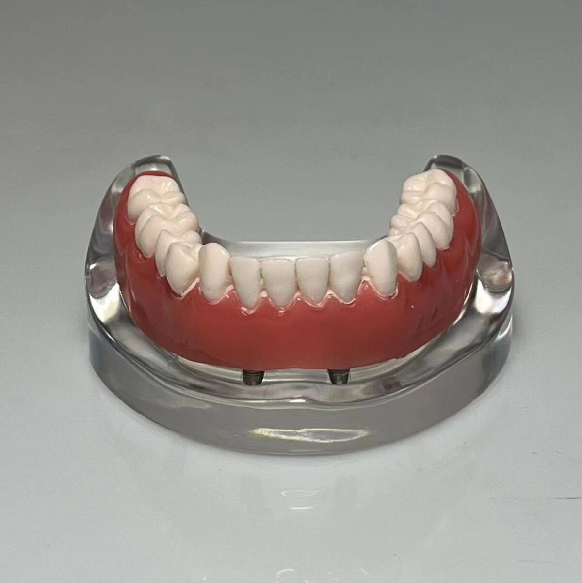 implant dental model