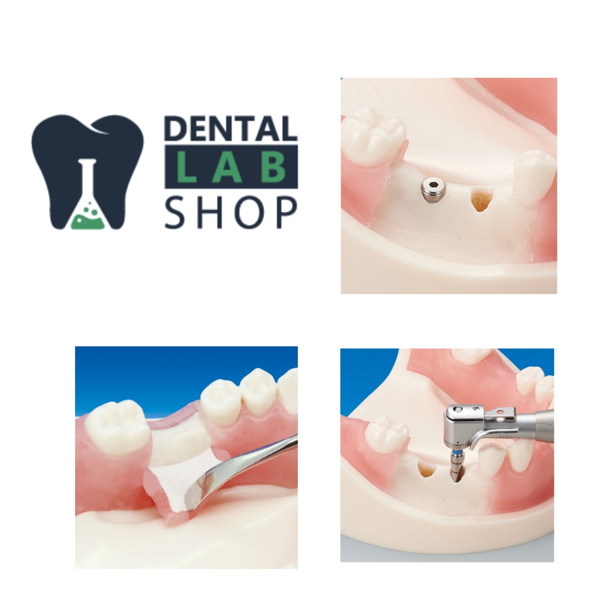 implant traing model application