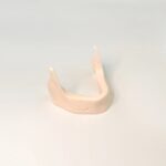 mandible implant perforating gingival module