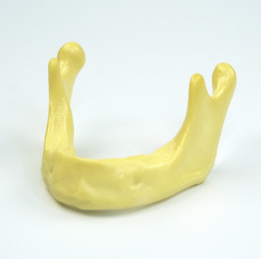 mandible implant training model
