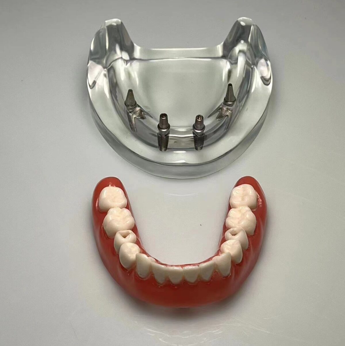 mandibular implant dental communication model