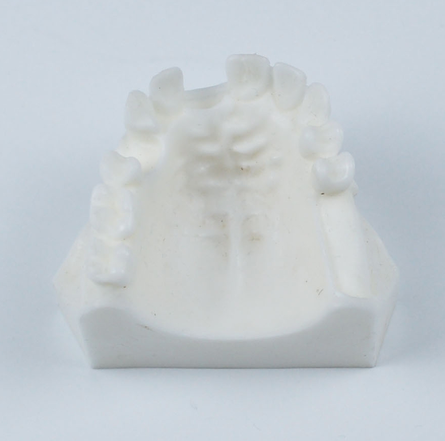 maxilla missing tooth model for implant drilling