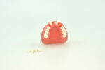 missing tooth dental model