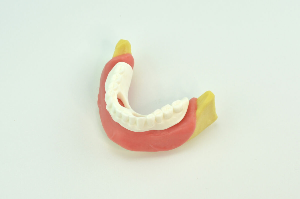 oral implant model for gingival mandible