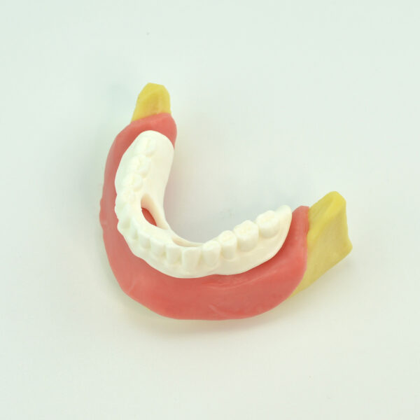 oral implant model for gingival mandible