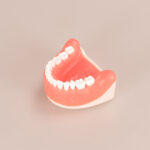 practicing tooth extraction model