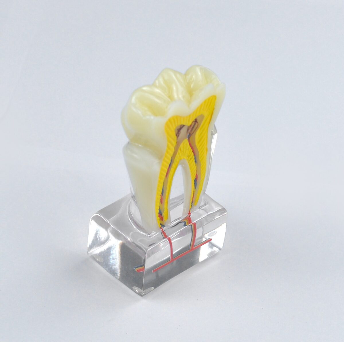 pulp cavity dental model