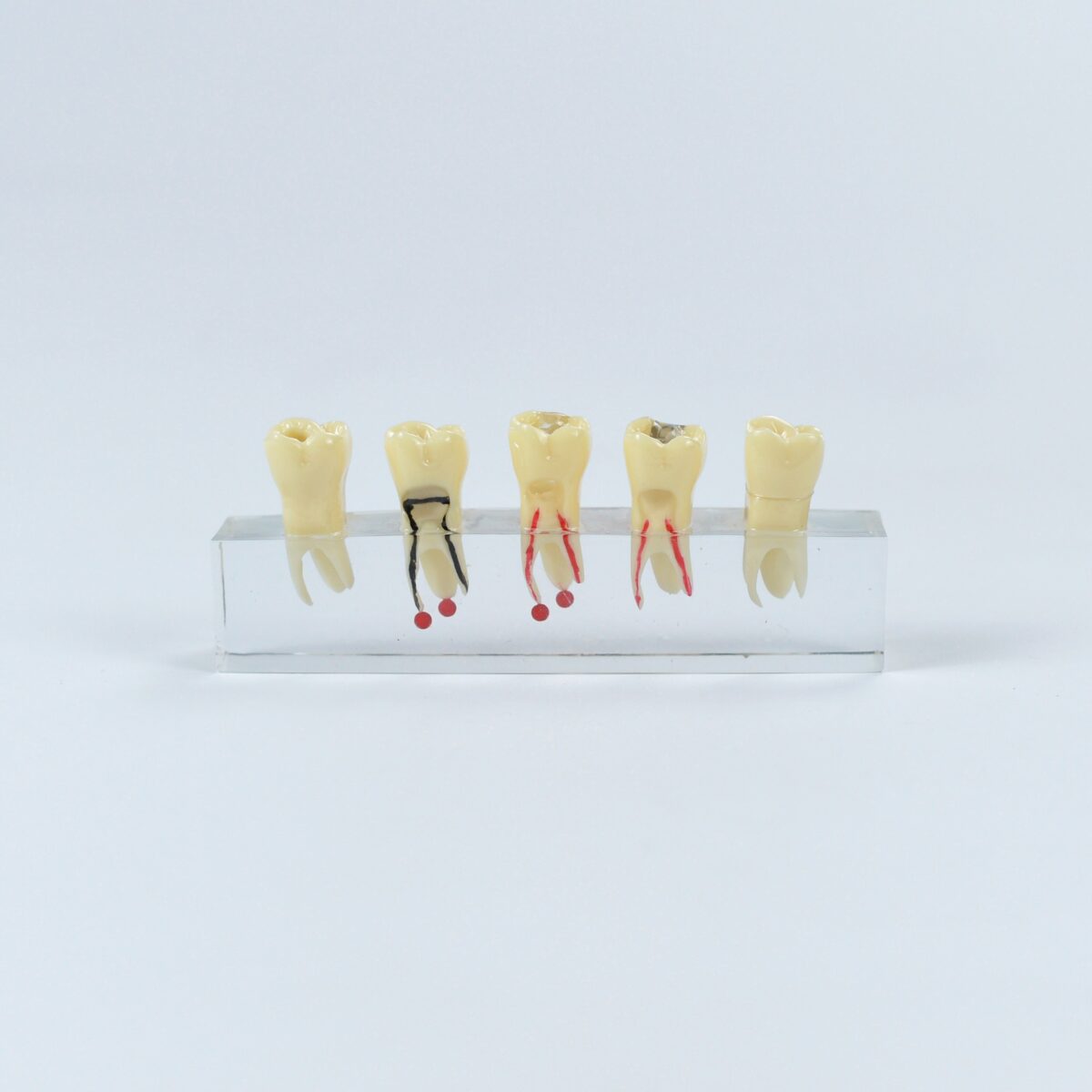 root canal communication model