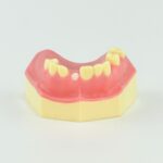 implant and residual root jaw model