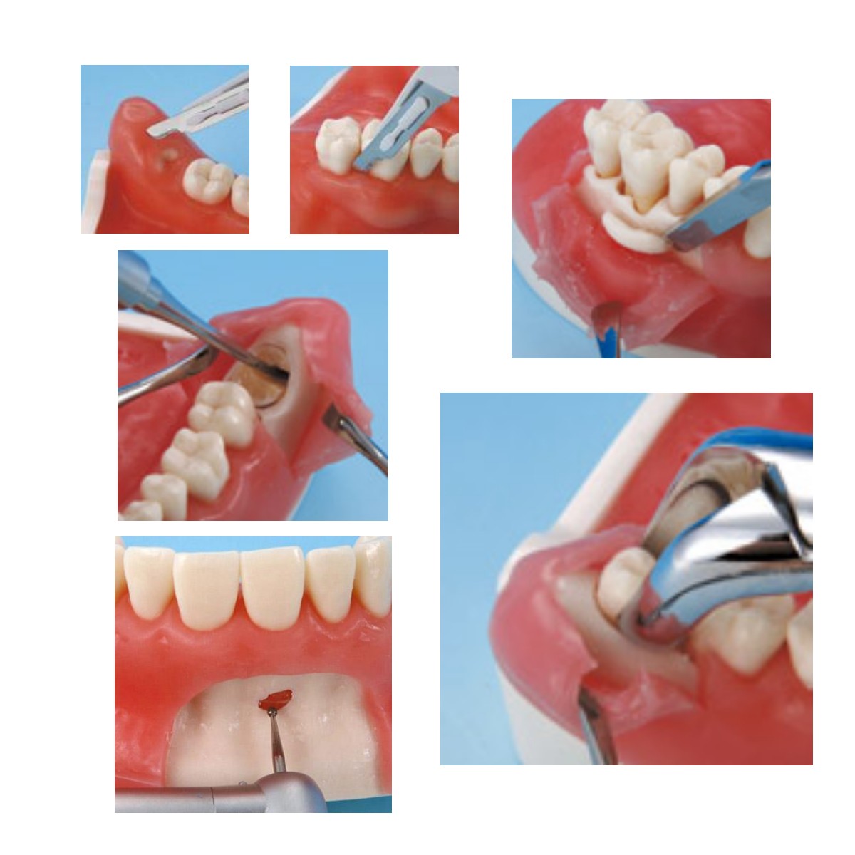 oral surgery model training specification