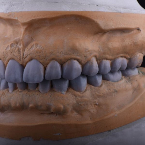 Dental lab supplies for accurate prosthetic fabrication