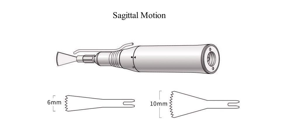 Sagittal motion