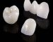 Dentistry porcelain crowns
